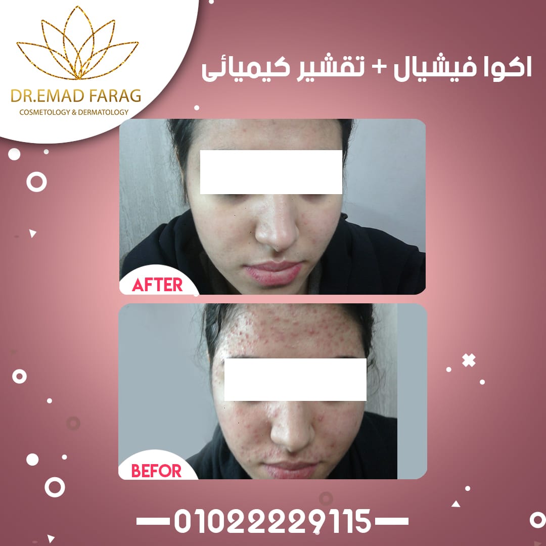 WhatsApp-Image-2020-05-03-at-1.46.25-AM.jpeg