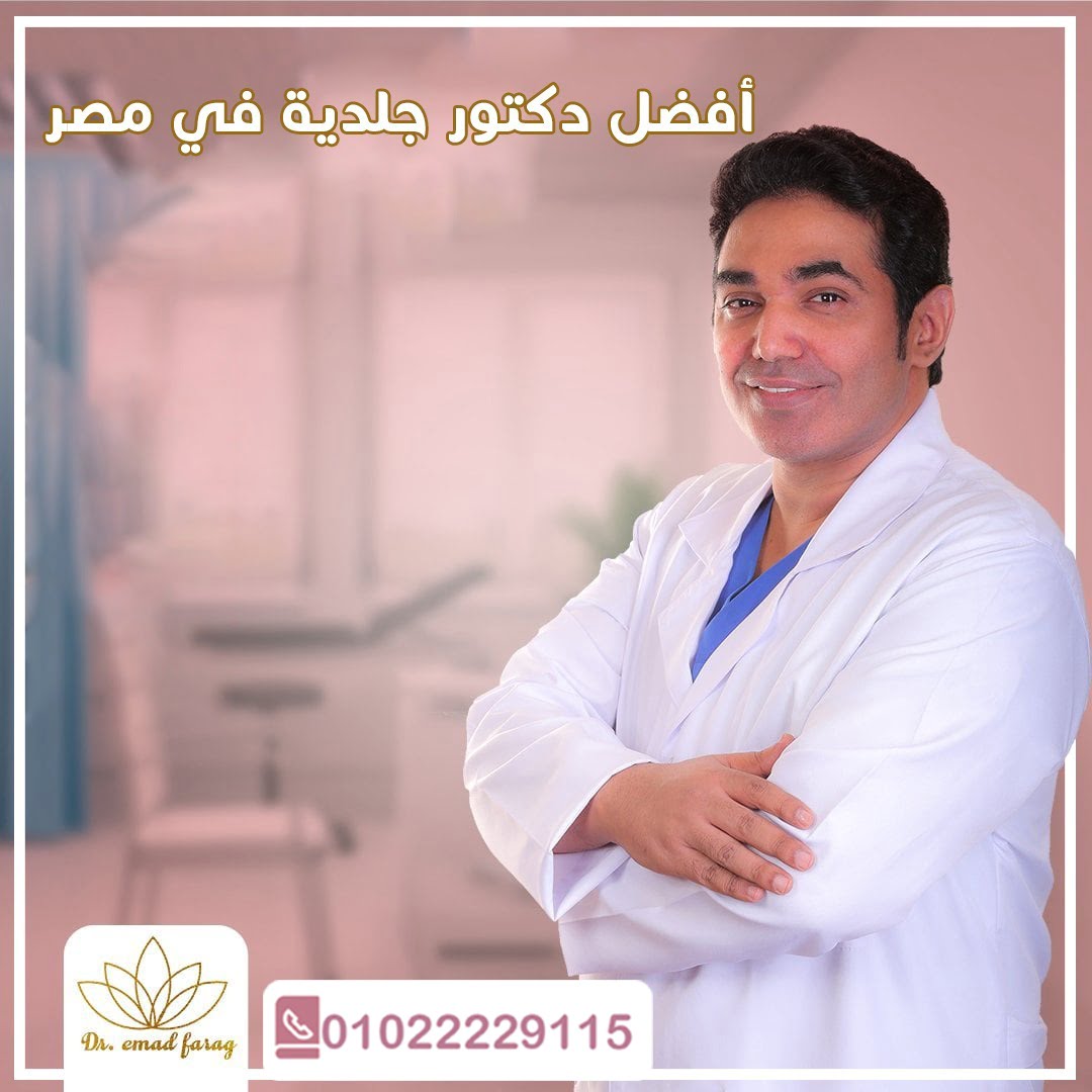 أفضل دكتور جلدية في مصر